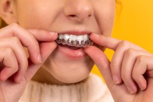 child putting in clear invisalign trays in mouth